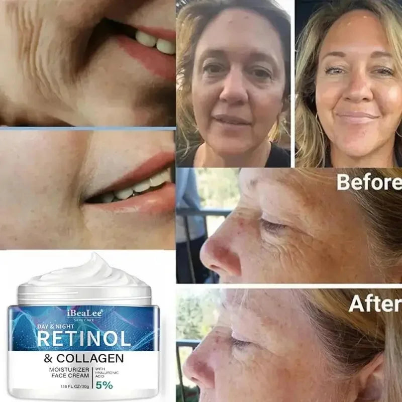 Retinol Anti-Wrinkle Cream for Men Collagen Anti-Aging Removal Face & Neck Wrinkle Efficient Moisturize Firming Korean Skin Care
