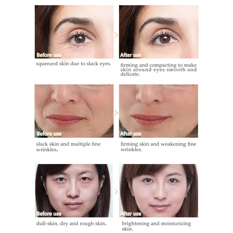 Peptide anti Wrinkle Facial Cream Firming Whitening Face Cream Acne Treatment Anti-Aging Hyaluronic Acid Snail Cream