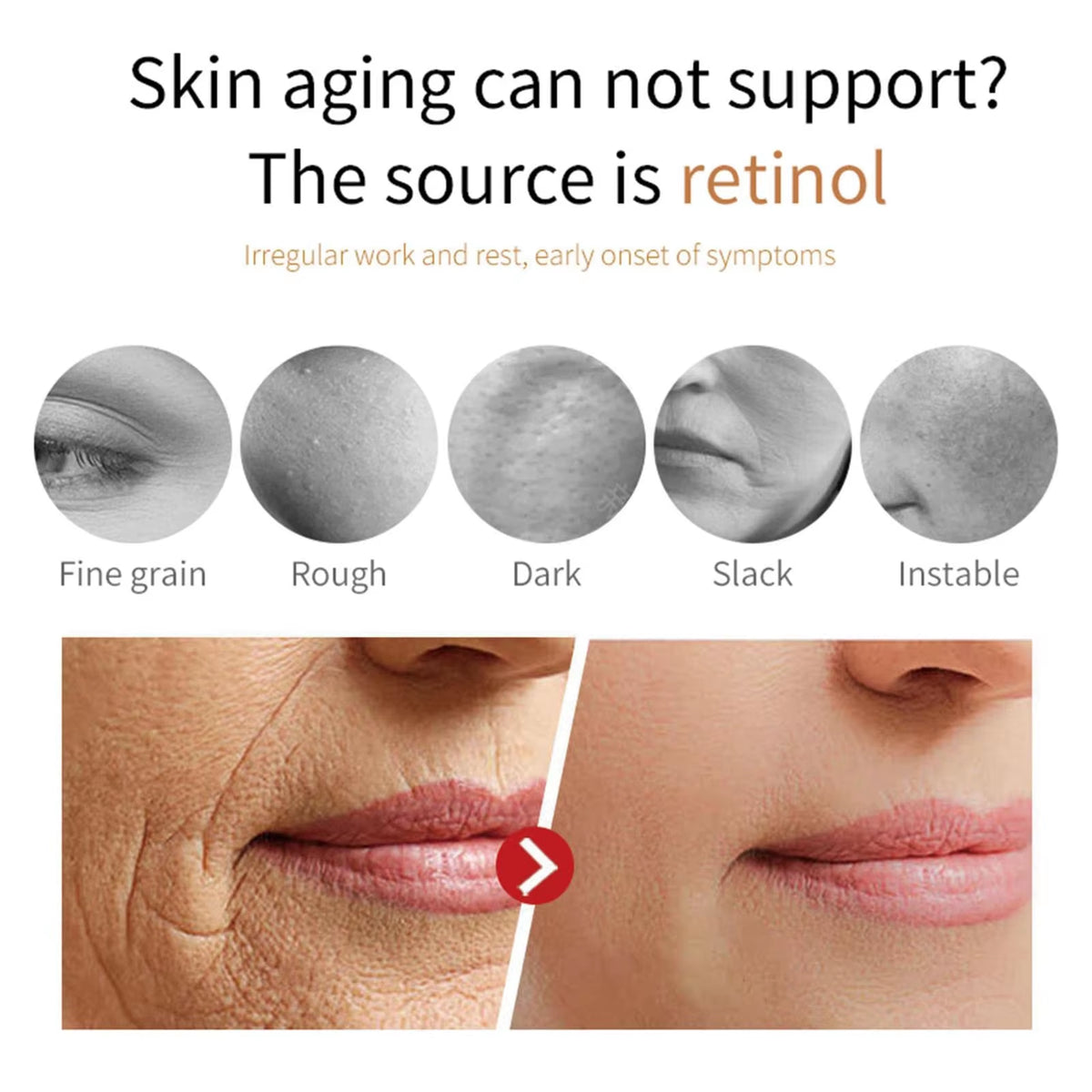 Miracles Retinol Face Cream, Miracles Retinol Moisturizing Cream, Retinol Anti-Wrinkle Face Cream, Reduces Wrinkles and Firms Sk